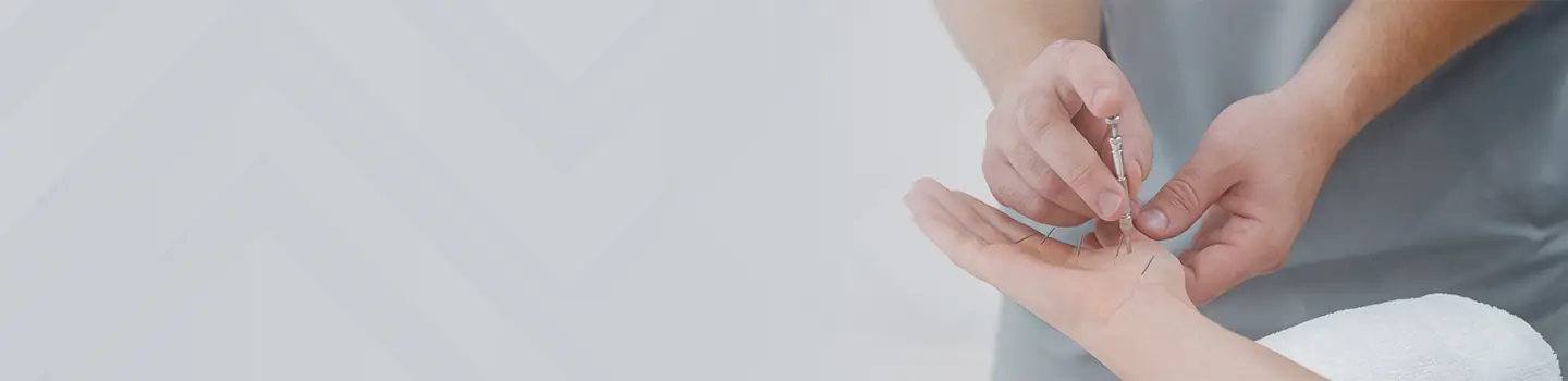 Acupuncture Therapy